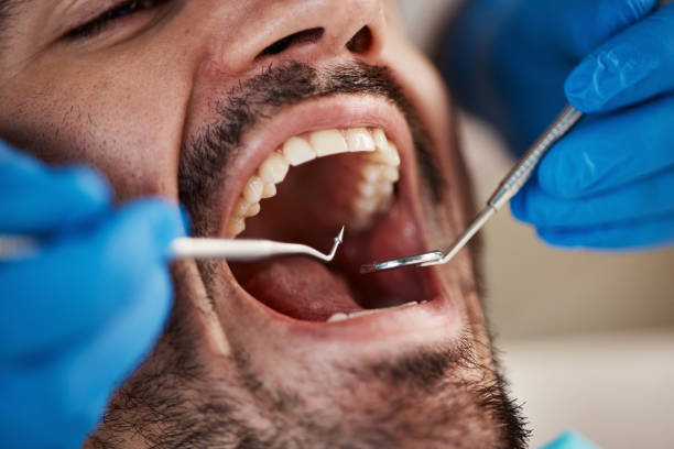 Best Urgent Tooth Repair  in Garden City, SC